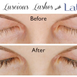 long and luscious lashes with latisse